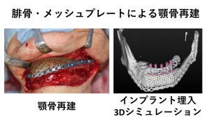 口腔 顎顔面外科学講座について 福岡歯科大学