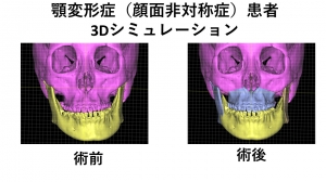 口腔 顎顔面外科学講座について 福岡歯科大学